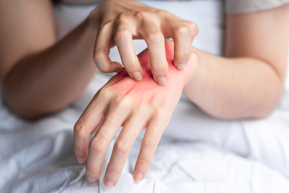 skin infection